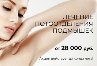 Лечение гипергидроза