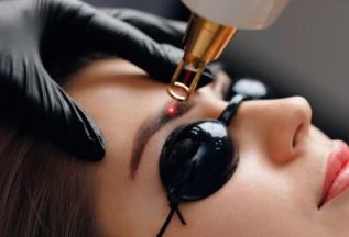 Скидка 25% на первый сеанс удаления татуажа бровей