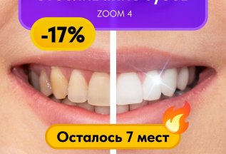 Скидка 6 000₽ на отбеливание ZOOM 4