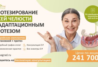 Протезирование всей челюсти на 6 имплантах