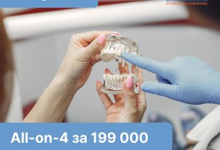 Улыбка мечты с All-on-4 всего за 199 000 ₽!