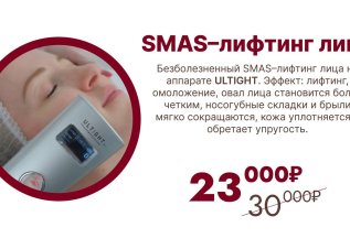 Smas-лифтинг