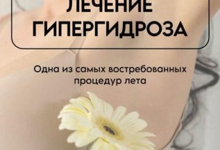Акция : НЕТ «потливости»