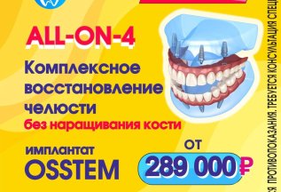 All-ON-4 Все на 4х альтернатива съёмному протезированию