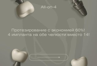 Что такое имплантация зуба?