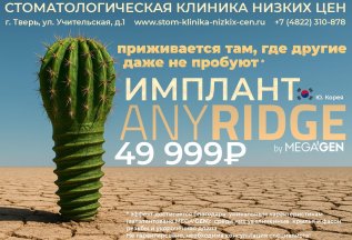 Имплант AnyRidge 49999 руб.