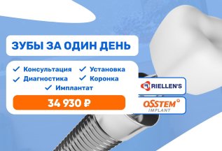 Имплантация зубов Система Osstem за 34 930 руб