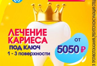 Лечение кариеса под ключ
