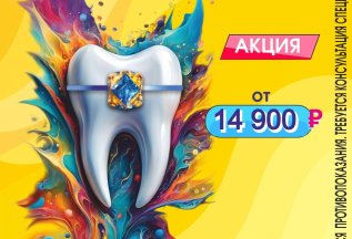 Акция на брекет-системы
