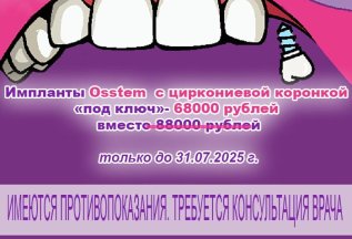 Акция на имплантацию