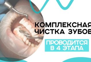 Комплексная чистка зубов