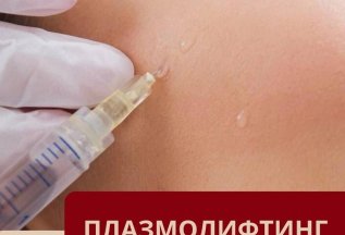 Плазмолифтинг