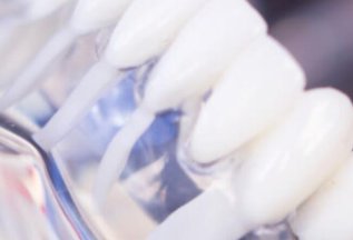 Имплантация зубов под ключ — от 50 000 р