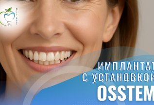 Имплантат Osstem с установкой