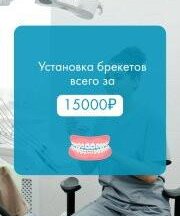 Установка брекетов всего 15 000₽