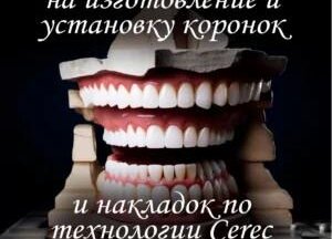 – 10% на изготовление и установку коронок по CEREC!