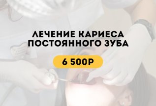 Лечение кариеса постоянного зуба за 6500