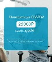 Имплантация OSSTEM 25000₽ вместо 42 000₽