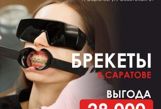 Установка брекетов с выгодой 28 000