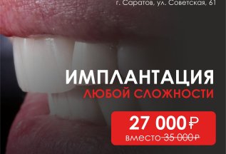 Имплантация зубов любой сложности
