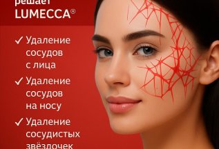Удаление сосудов на IPL! Акция!
