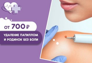 УДАЛЕНИЕ ПАПИЛЛОМ И РОДИНОК БЕЗ БОЛИ от 700₽