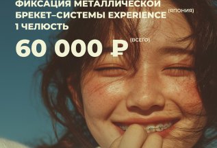 БРЕКЕТ-СИСТЕМА EXPERIENCE