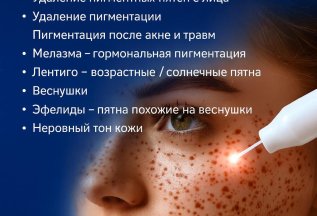 Пигментные пятна - удаление с лица. Акция 11200 р!