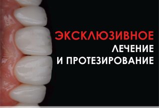Лечение и протезирование