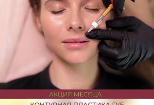 Формула идеальных губ с Belotero за 13 020₽