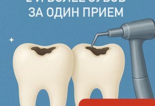 Лечение кариеса двух и более зубов со скидкой