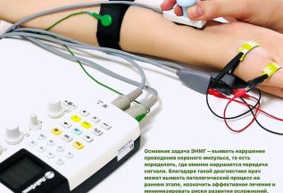 Электронейромиография
