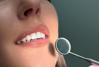 Профессиональная чистка зубов + отбеливание