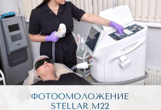 Фотоомоложение Stellar M22 — заметный эффект с первого раза