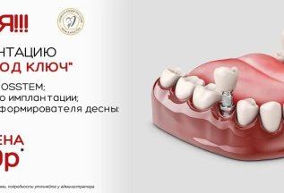 Акция! Имплантация OSSTEM 
