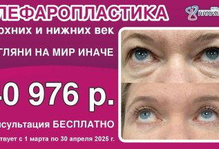 🟢 БЛЕФАРОПЛАСТИКА ВЕРХНИХ И НИЖНИХ ВЕК. Предварительная кон