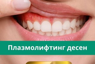 Плазмолифтинг десен