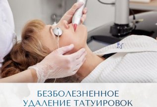Пикосекундное удаление татуировок PicoCare — без боли