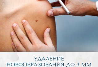 Удаление новообразований: быстро, точно, без швов
