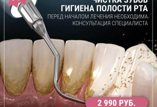 Профессиональная гигиена полости рта за пол цены!