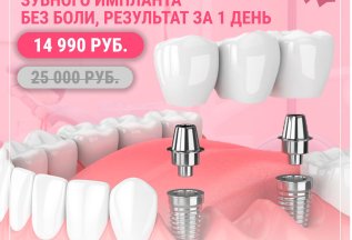 Имплантация под ключ за 1 день