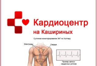 Суточное мониторирование