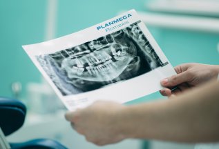Два имплантата по цене одного!!!