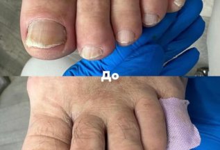 О консультации на первом визите