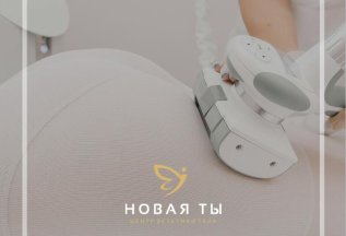 RF-лифтинг тела