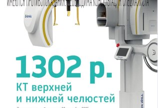 КТ верхней и нижней челюстей