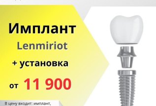 Установка зубного импланта от 11 900 руб