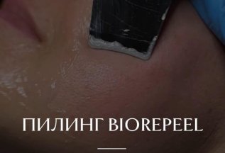 Комбинированная чистка лица