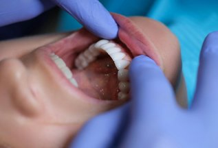 Имплант первичным пациентам в подарок!🦷