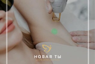 Лазерная эпиляция: Подмышки + бикини тотал +голени с коленом